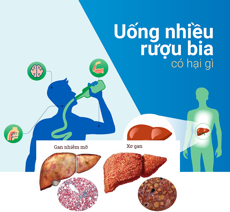 Rượu bia và sức khỏe ngày Tết