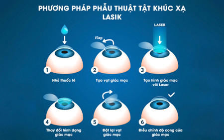 CÁC PHƯƠNG PHÁP PHẪU THUẬT KHÚC XẠ